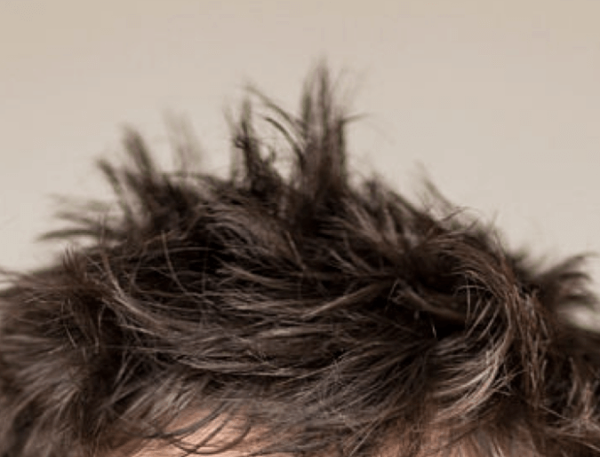 Cheveux ébouriffés
