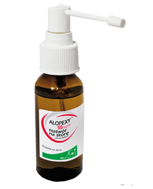 Łysienie androgenowe o umiarkowanym nasileniu u mężczyzn